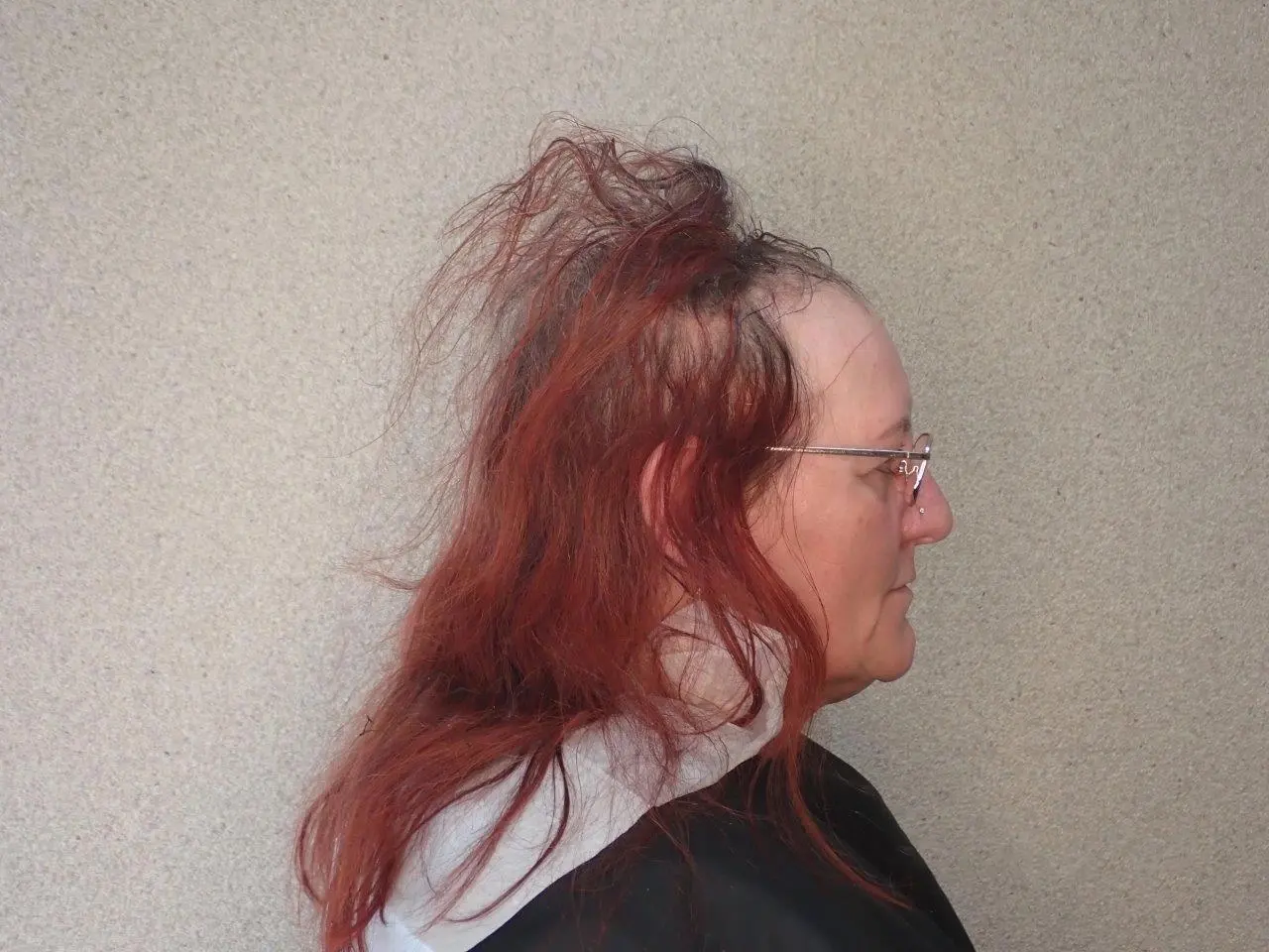 Feines, schütteres Haar vor der Behandlung